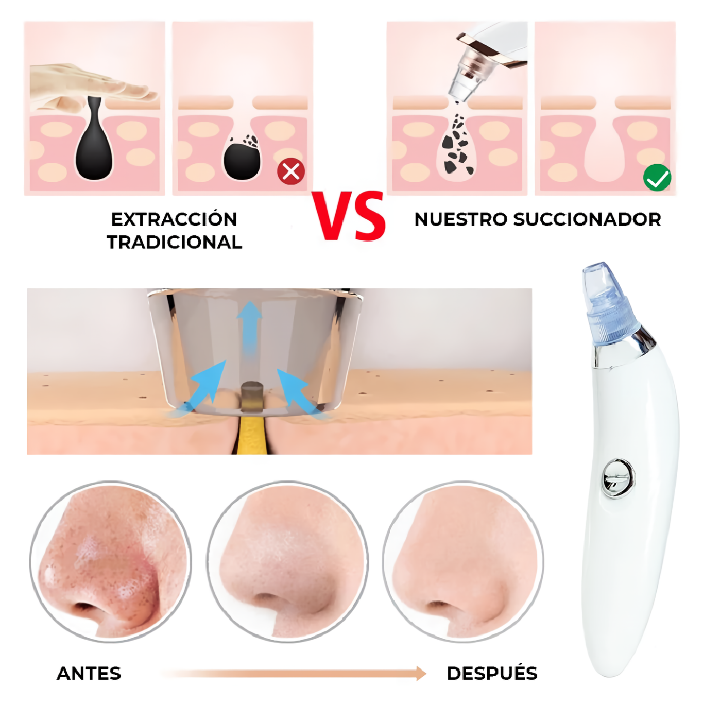 Punto Final Pro™ – Extractor de Puntos Negros y Espinillas